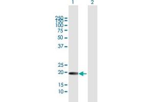 Western Blot analysis of GH1 expression in transfected 293T cell line by GH1 MaxPab polyclonal antibody. (Growth Hormone 1 抗体  (AA 1-217))