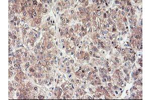 Image no. 14 for anti-NIF3 NGG1 Interacting Factor 3-Like 1 (NIF3L1) antibody (ABIN1496615) (NIF3L1 抗体)