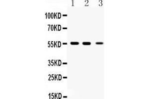 Western blot analysis of Beta III Tubulin expression in rat brian extract ( Lane 1), mouse brain extract ( Lane 2) and HELA whole cell lysates ( Lane 3). (TUBB3 抗体  (C-Term))