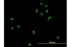 Immunofluorescence of monoclonal antibody to CSE1L on HeLa cell. (Exportin 2 抗体  (AA 872-971))