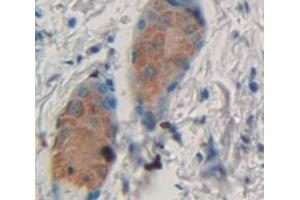 Immunohistochemistry (IHC) image for anti-Prostaglandin D2 Synthase (PTGDS) (AA 1-199) antibody (ABIN1870063)