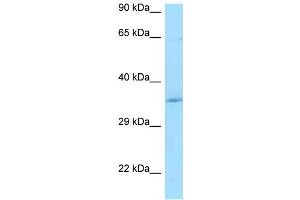 WB Suggested Anti-CCDC117 Antibody Titration: 1. (CCDC117 抗体  (Middle Region))