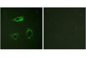 Immunofluorescence analysis of HepG2 cells, using CD18/ITGB2 (Phospho-Thr758) Antibody. (Integrin beta 2 抗体  (pThr758))