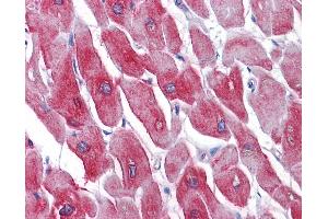 Immunohistochemistry (IHC) image for anti-ATPase, Ca++ Transporting, Cardiac Muscle, Fast Twitch 1 (ATP2A1) (AA 522-613) antibody (ABIN574210)