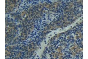 Detection of FASL in Rat Uterus Tissue using Polyclonal Antibody to Factor Related Apoptosis Ligand (FASL)