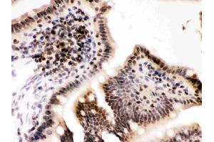 Cyclin T1 was detected in paraffin-embedded sections of mouse intestine tissues using rabbit anti- Cyclin T1 Antigen Affinity purified polyclonal antibody (Catalog # ) at 1 ? (Cyclin T1 抗体  (Middle Region))