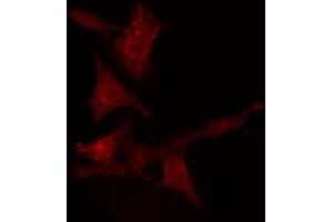 ABIN6275547 staining  Hela cells by IF/ICC. (PPP2R5D 抗体  (C-Term))