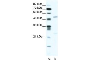Western Blotting (WB) image for anti-Bromodomain Containing 9 (BRD9) antibody (ABIN2461055) (BRD9 抗体)