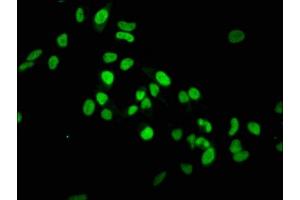 Immunofluorescence staining of Hela cells with ABIN7127301 at 1:37. (Recombinant HIST1H3A 抗体  (H3K36me))