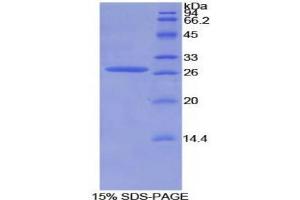 SDS-PAGE analysis of Mouse AXIN Protein. (Axin 蛋白)