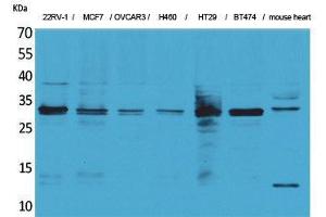 Western Blotting (WB) image for anti-Latexin (LXN) (Internal Region) antibody (ABIN3187682) (Latexin 抗体  (Internal Region))