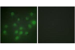 Immunofluorescence analysis of HuvEc cells, using HKR1 Antibody.