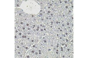 Immunohistochemistry of paraffin-embedded mouse liver using MYC antibody. (c-MYC 抗体)