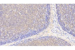 Immunohistochemistry (IHC) image for anti-Phospholipase C, delta 4 (PLCD4) (AA 1-250) antibody (ABIN7445174)