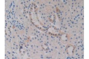 Immunohistochemistry (IHC) image for anti-Fc Fragment of IgA, Receptor For (FCAR) (AA 51-280) antibody (ABIN7443131)