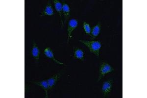 IF analysis of HGS using anti-HGS antibody (ABIN7601205).