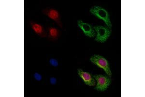 ABIN6262106 and ABIN6273119 staining Hela by IF/ICC.