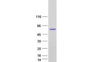 Western Blotting (WB) image for Pyruvate Dehydrogenase Phosphatase (PDP) (Transcript Variant 4) protein (Myc-DYKDDDDK Tag) (ABIN2728599)