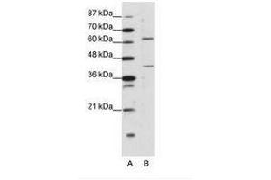 Image no. 1 for anti-Forkhead Box P4 (FOXP4) (C-Term) antibody (ABIN203239) (FOXP4 抗体  (C-Term))