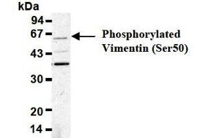 Western Blotting (WB) image for anti-Vimentin (VIM) (pSer50) antibody (ABIN1449160)
