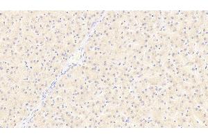 Immunohistochemistry (IHC) image for anti-Carcinoembryonic Antigen-Related Cell Adhesion Molecule 1 (CEACAM1) antibody (ABIN7435280)