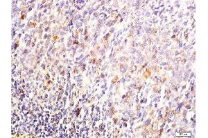 Formalin-fixed and paraffin embedded mouse lymphoma tissue labeled with Anti-DUSP1/MKP-1 Polyclonal Antibody, Unconjugated  at 1:200, followed by conjugation to the secondary antibody and DAB staining (DUSP1 抗体  (AA 151-250))