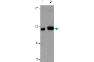 Western blot analysis of IFITM1 in NIH/3T3 cell lysate with IFITM1 polyclonal antibody  at (1) 1 and (2) 2 ug/mL. (IFITM1 抗体  (Internal Region))