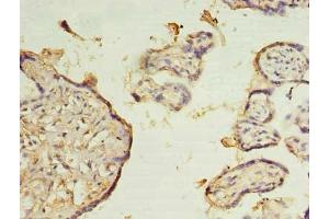 Immunohistochemistry of paraffin-embedded human placenta tissue using ABIN7176101 at dilution of 1:100 (ZMYND19 抗体  (AA 1-227))