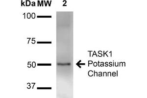 Western Blot analysis of Rat Brain Membrane showing detection of ~50 kDa TASK1 Potassium Channel protein using Mouse Anti-TASK1 Potassium Channel Monoclonal Antibody, Clone S374-48 . (KCNK3 抗体  (AA 251-411) (Atto 390))
