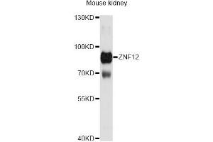 Western blot analysis of extracts of mouse kidney, using ZNF12 Antibody (ABIN6291084) at 1:3000 dilution. (ZNF12 抗体)