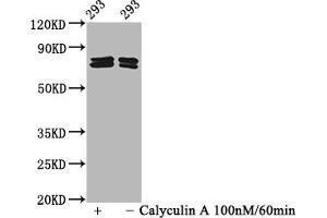 Western Blot Positive WB detected in 293 whole cell lysate(treated with Calyculin A or not) All lanes Phospho-PAK4/PAK5/PAK6 antibody at 2. (Recombinant PAK4/PAK5/PAK6 (pSer474), (pSer560), (pSer602) 抗体)