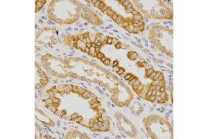 Immunohistochemistry of paraffin-embedded human kidney using IL23R antibody at dilution of 1:200 (x400 lens) (IL23R 抗体)
