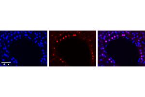 Immunohistochemistry (IHC) image for anti-Sterol Regulatory Element Binding Transcription Factor 1 (SREBF1) (Middle Region) antibody (ABIN2792233)