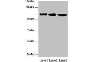 Western blot All lanes: CATSPER2 antibody at 4 μg/mL Lane 1: Jurkat whole cell lysate Lane 2: HepG2 whole cell lysate Lane 3: 293T whole cell lysate Secondary Goat polyclonal to rabbit IgG at 1/10000 dilution Predicted band size: 63, 62, 49, 24 kDa Observed band size: 63 kDa (CATSPER2 抗体  (AA 5-112))