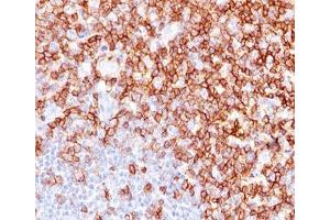 IHC testing of human tonsil stained with CD45RO antibody (UCHL-1). (CD45RO 抗体)