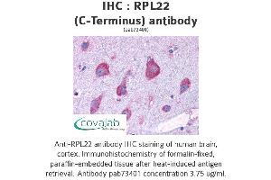 Image no. 1 for anti-Ribosomal Protein L22 (RPL22) (C-Term) antibody (ABIN1738940) (RPL22 抗体  (C-Term))