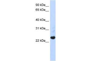 WB Suggested Anti-C21orf56 Antibody Titration:  0. (C21ORF56 抗体  (N-Term))