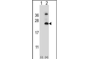 Western blot analysis of TSN6 (arrow) using rabbit polyclonal TSN6 Antibody (C-term) (ABIN6242668 and ABIN6579053). (Tetraspanin 6 抗体  (C-Term))