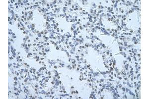 Rabbit Anti-THOC1 Antibody       Paraffin Embedded Tissue:  Human alveolar cell   Cellular Data:  Epithelial cells of renal tubule  Antibody Concentration:   4. (THOC1 抗体  (C-Term))