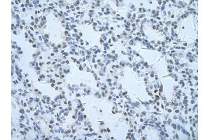 Rabbit Anti-THOC1 Antibody       Paraffin Embedded Tissue:  Human alveolar cell   Cellular Data:  Epithelial cells of renal tubule  Antibody Concentration:   4. (THOC1 抗体  (C-Term))