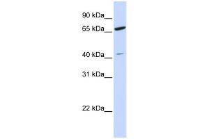 WB Suggested Anti-ZNF334 Antibody Titration: 0. (ZNF334 抗体  (N-Term))