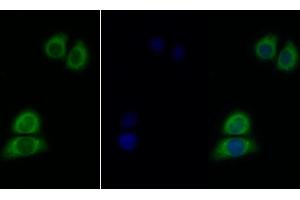 Detection of IL11Ra in Human Hela cell using Polyclonal Antibody to Interleukin 11 Receptor Alpha (IL11Ra) (IL11RA 抗体  (AA 59-217))