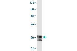 Western Blot detection against Immunogen (33 KDa) . (SCN11A 抗体  (AA 1726-1791))