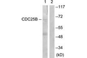 Western blot analysis of extracts from Raw264. (CDC25B 抗体  (AA 319-368))
