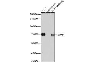 Immunoprecipitation analysis of 200 μg extracts of HeLa cells using 3 μg SOX9 antibody (ABIN7270577). (SOX9 抗体)