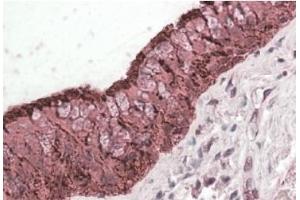 AP20183PU-N ALDH3A1 antibody staining of paraffin embedded Human Lung at 3. (ALDH3A1 抗体  (C-Term))