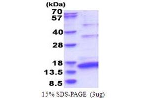 SDS-PAGE (SDS) image for Hepatitis C Virus NS5a (HCV NS5a) (AA 2210-2306) protein (His tag) (ABIN6387451) (HCV NS5a Protein (AA 2210-2306) (His tag))