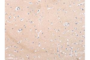 The image on the left is immunohistochemistry of paraffin-embedded Human brain tissue using ABIN7193105(ZNF106 Antibody) at dilution 1/20, on the right is treated with synthetic peptide. (ZNF16 抗体)