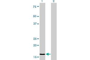 Western Blotting (WB) image for anti-Nucleoside diphosphate kinase B (NME2) (AA 1-152) antibody (ABIN562007)