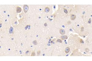 Immunohistochemistry (IHC) image for anti-Coagulation Factor III (thromboplastin, Tissue Factor) (F3) (AA 36-292) antibody (ABIN7442990)
